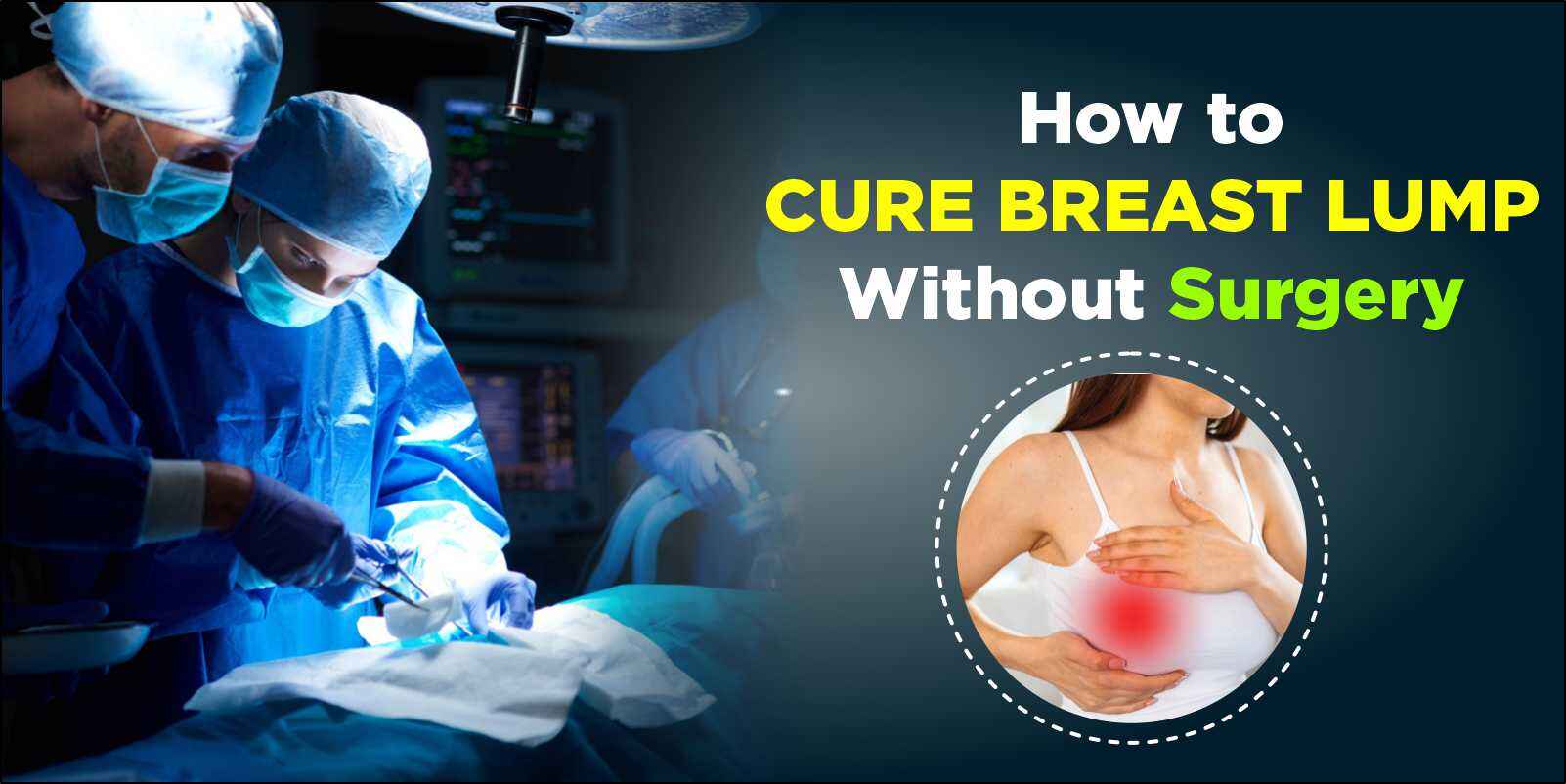 How to Cure Breast Lump Without Surgery